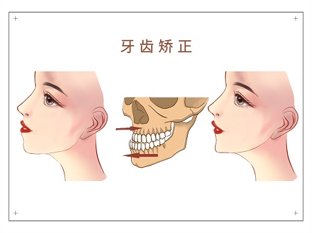 牙齿变稀疏了怎么回事？牙齿稀疏牙缝大怎么办？